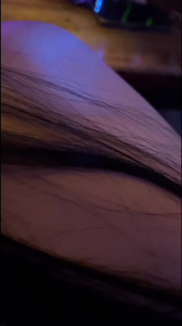 03年微熏醫美前台直接拿下